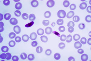 Plasmodium_falciparum_wiki_CDC_Dr. Mae Melvin Transwiki